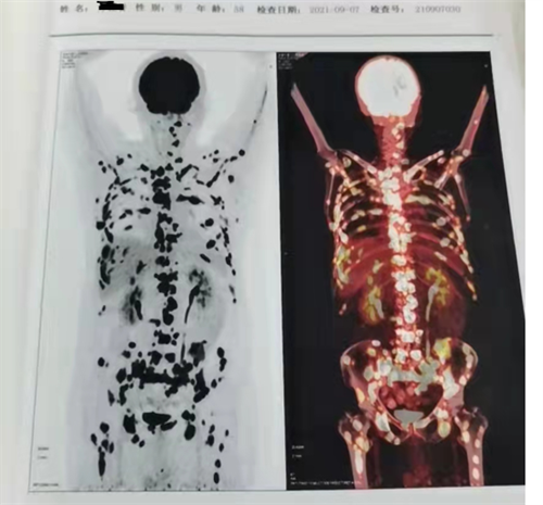 6225a80de67bf.png 6225a80de67bf.png