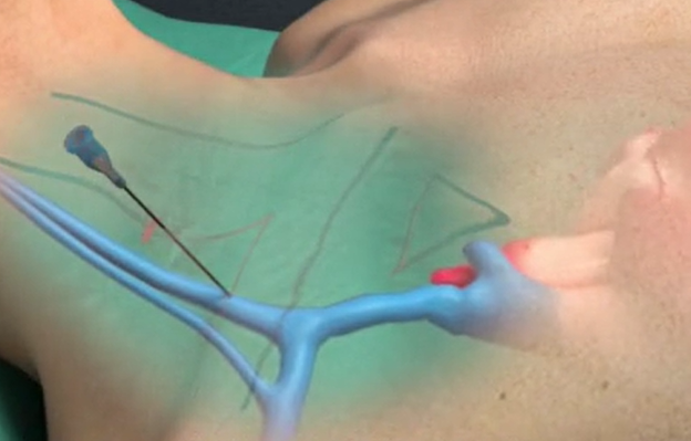 62eb3092dfc9a.png 62eb3092dfc9a.png