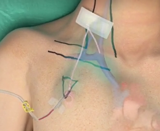 62eb30bd6b073.png 62eb30bd6b073.png